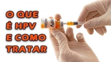 Hpv O Que Causas Sintomas E Tratamento Buscar Sa De