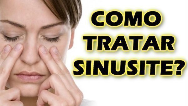 Sinusite! Causas, Sintomas E Tratamento - Buscar Saúde