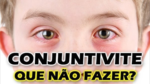 Conjuntivite O Que Fazer Causas Sintomas E Tratamentos