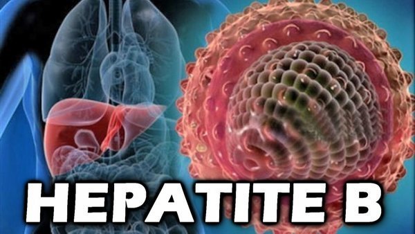 O Que é Hepatite B? Sintomas E Tratamento! - Buscar Saúde