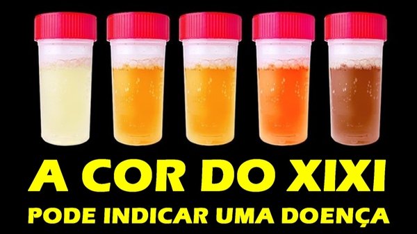 Cor do xixi pode ser sinal de doença Buscar Saúde