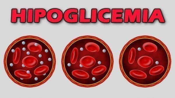 Hipoglicemia O Que é Causas Sintomas E Tratamento Buscar Saúde